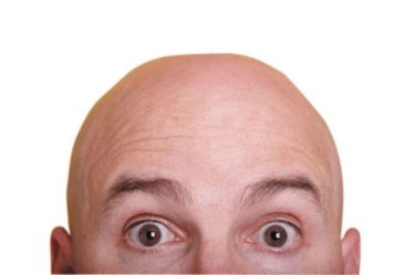 Filtro que deixa você careca