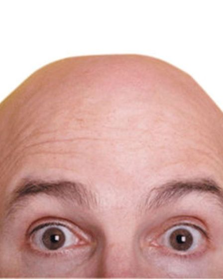 Filtro que deixa você careca