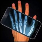 Aplicativos para simular raio-X no celular