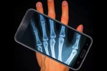 Aplicativos para simular raio-X no celular