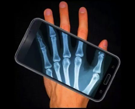Aplicativos para simular raio-X no celular