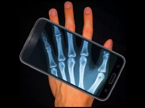 Aplicativos para simular raio-X no celular